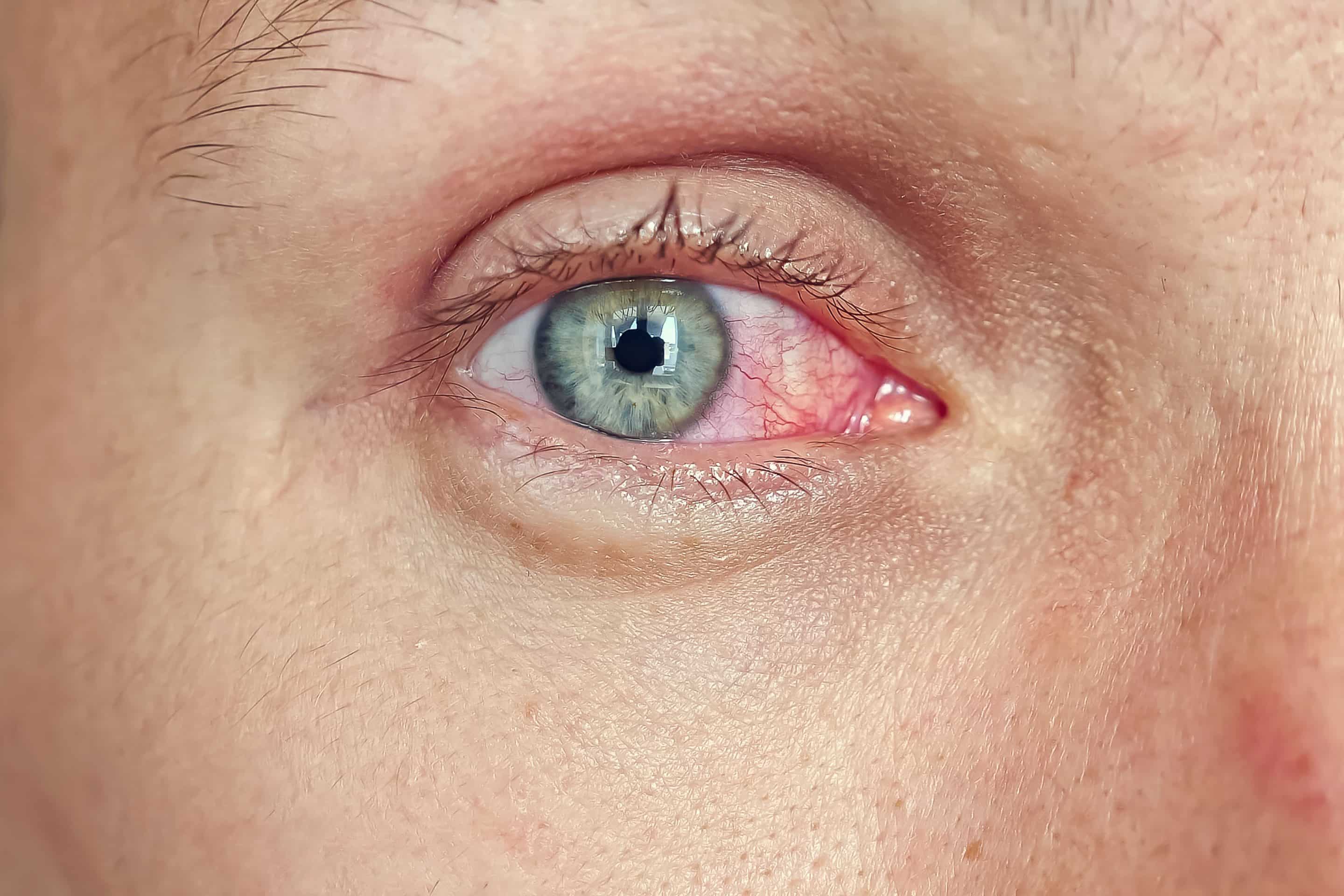 Close-up of a male face with red eyes