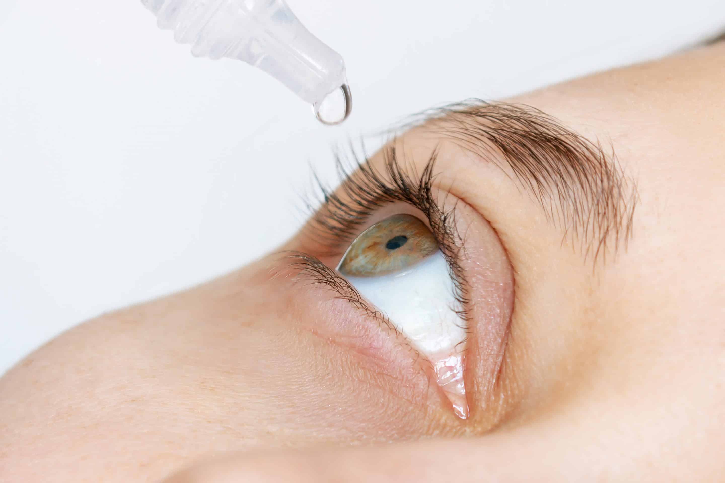 cropped-shot-woman-dripping-her-eyes-with-medicinal-drops-natural-tear-close-up